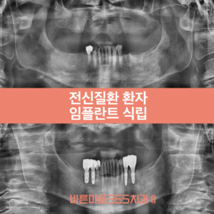 울산삼산동임플란트