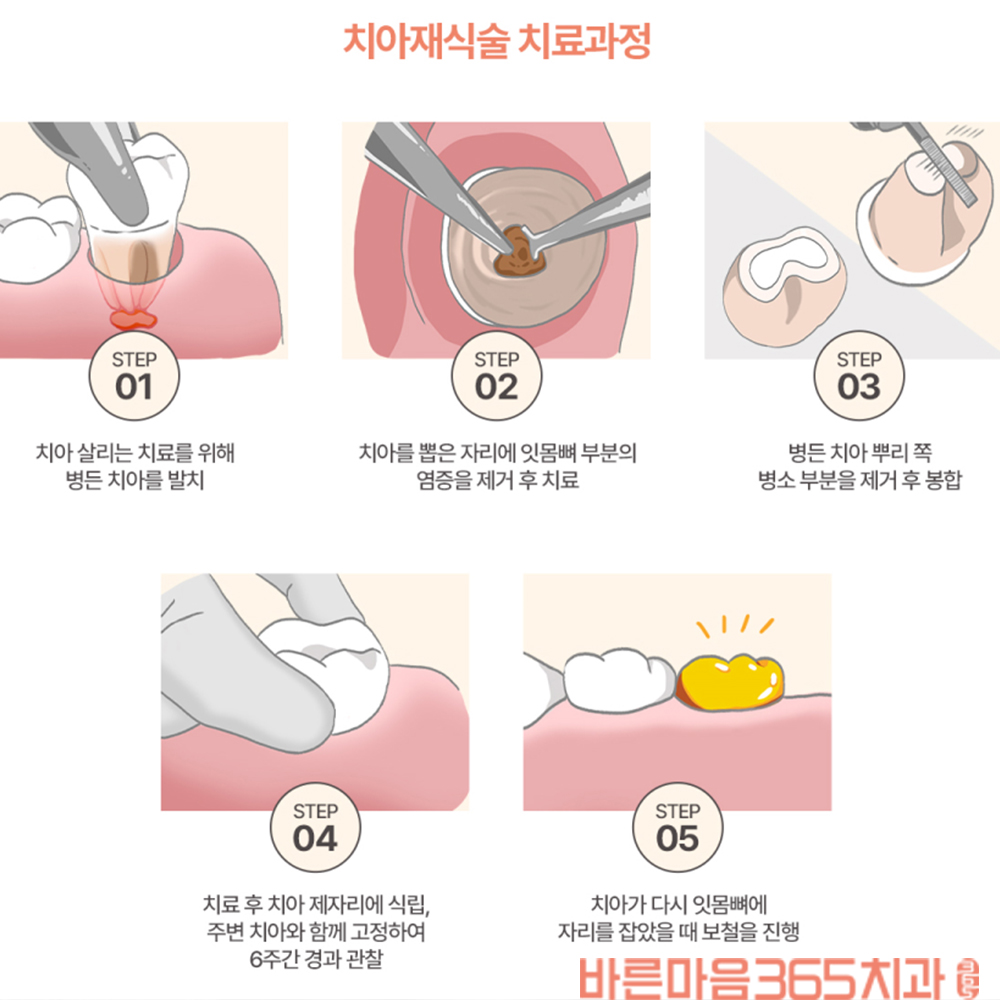 울산남구치과,