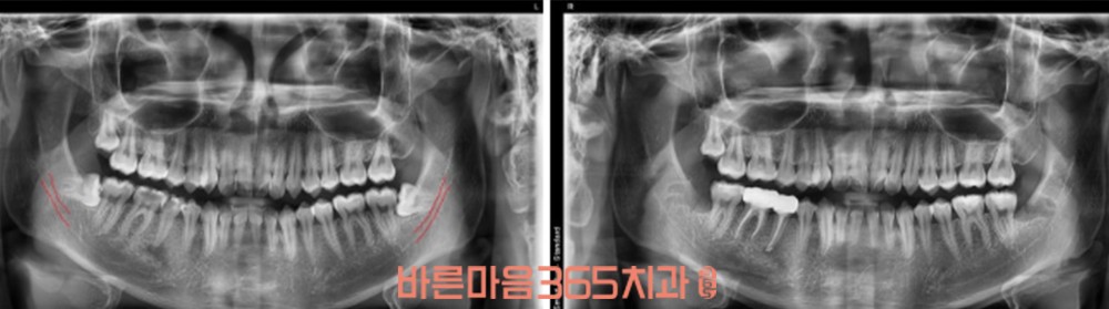 울삼삼산동치과
