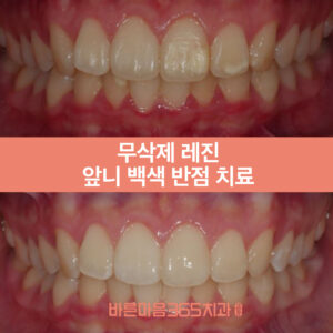 울산삼산동치과