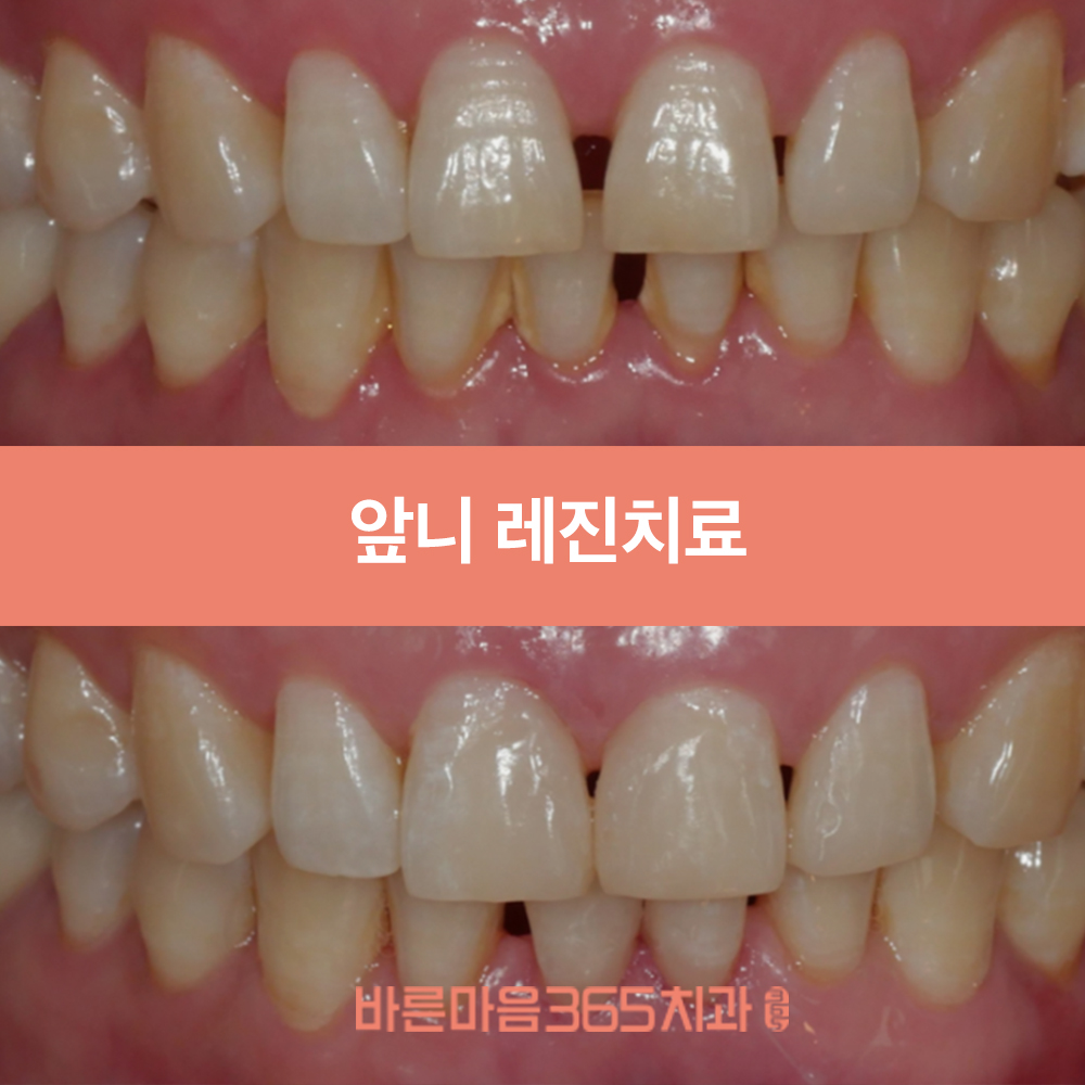 울산삼산동치과