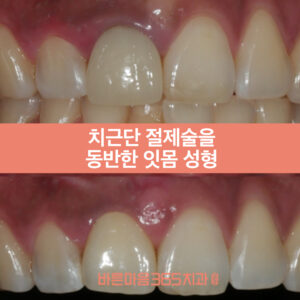 울산삼산동치과