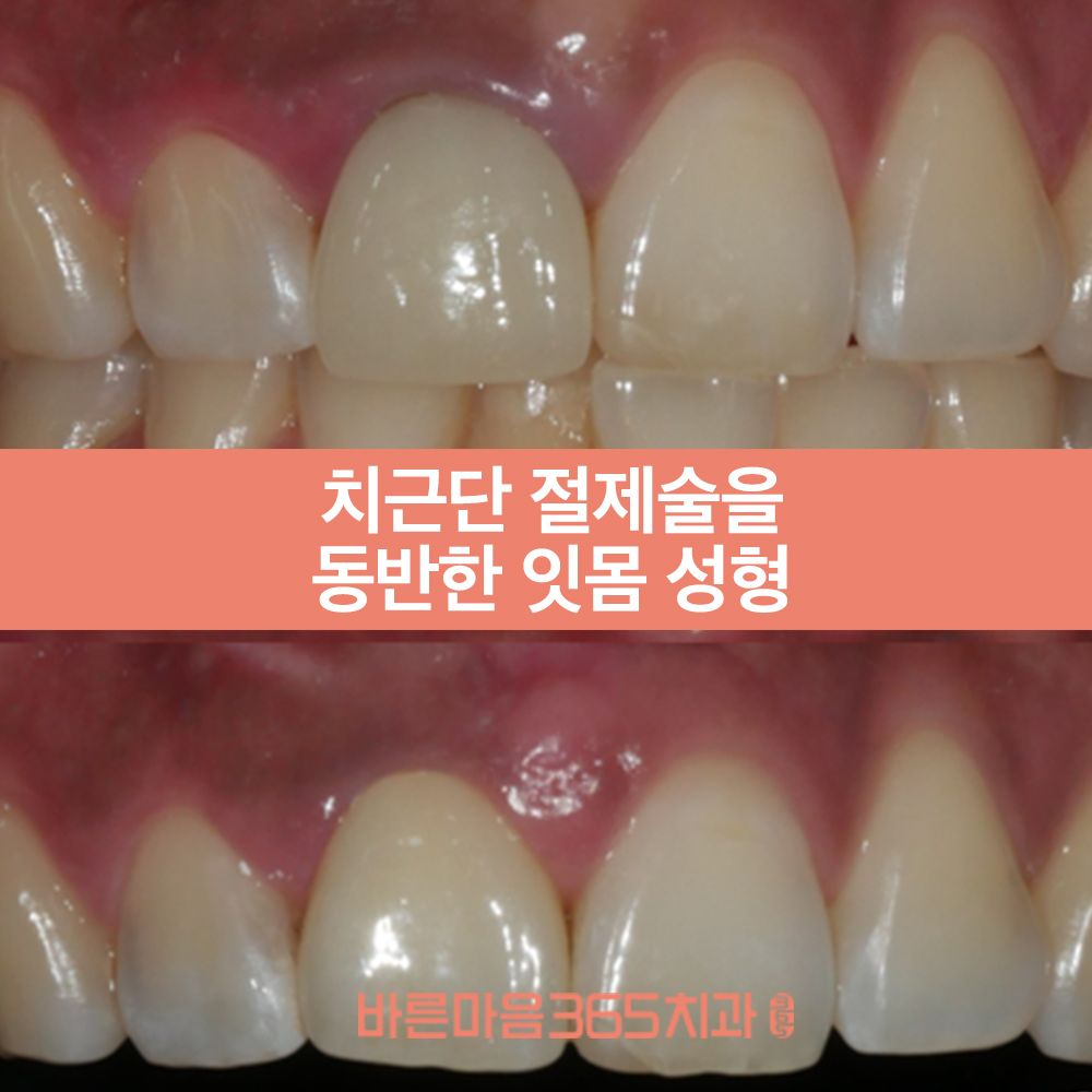 울산삼산동치과