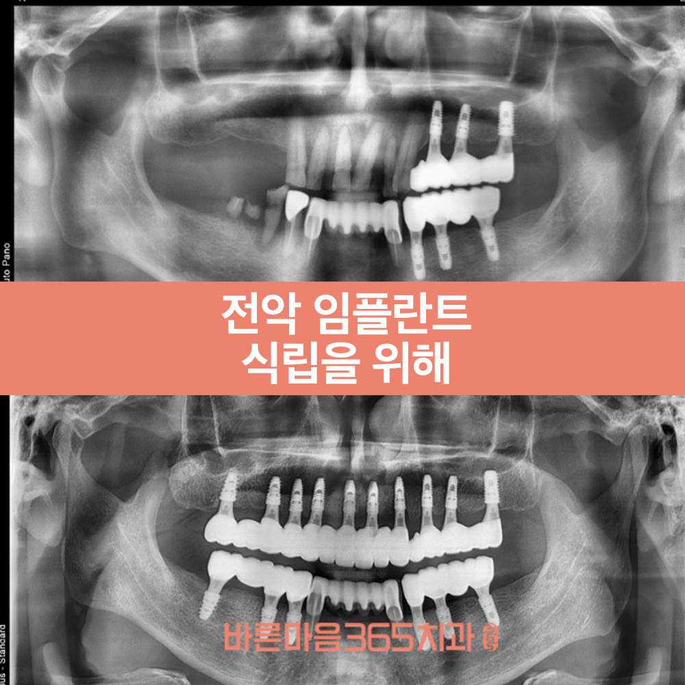 울산삼산동치과
