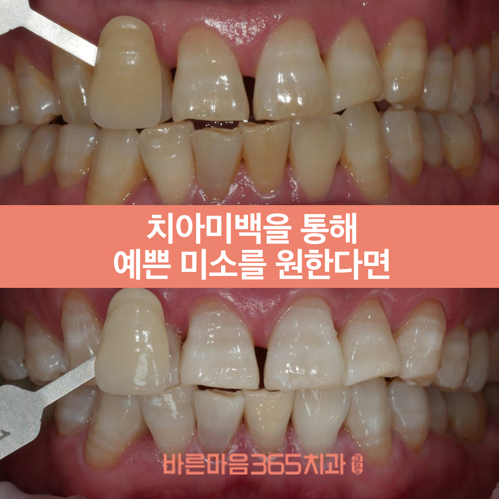 울산삼산동치과