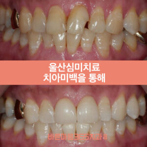 울산삼산동치과