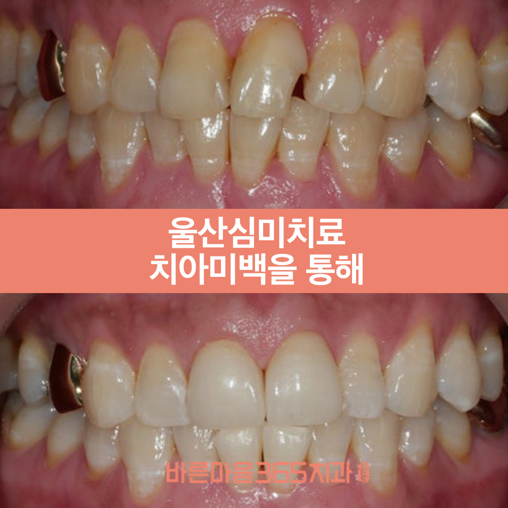 울산삼산동치과