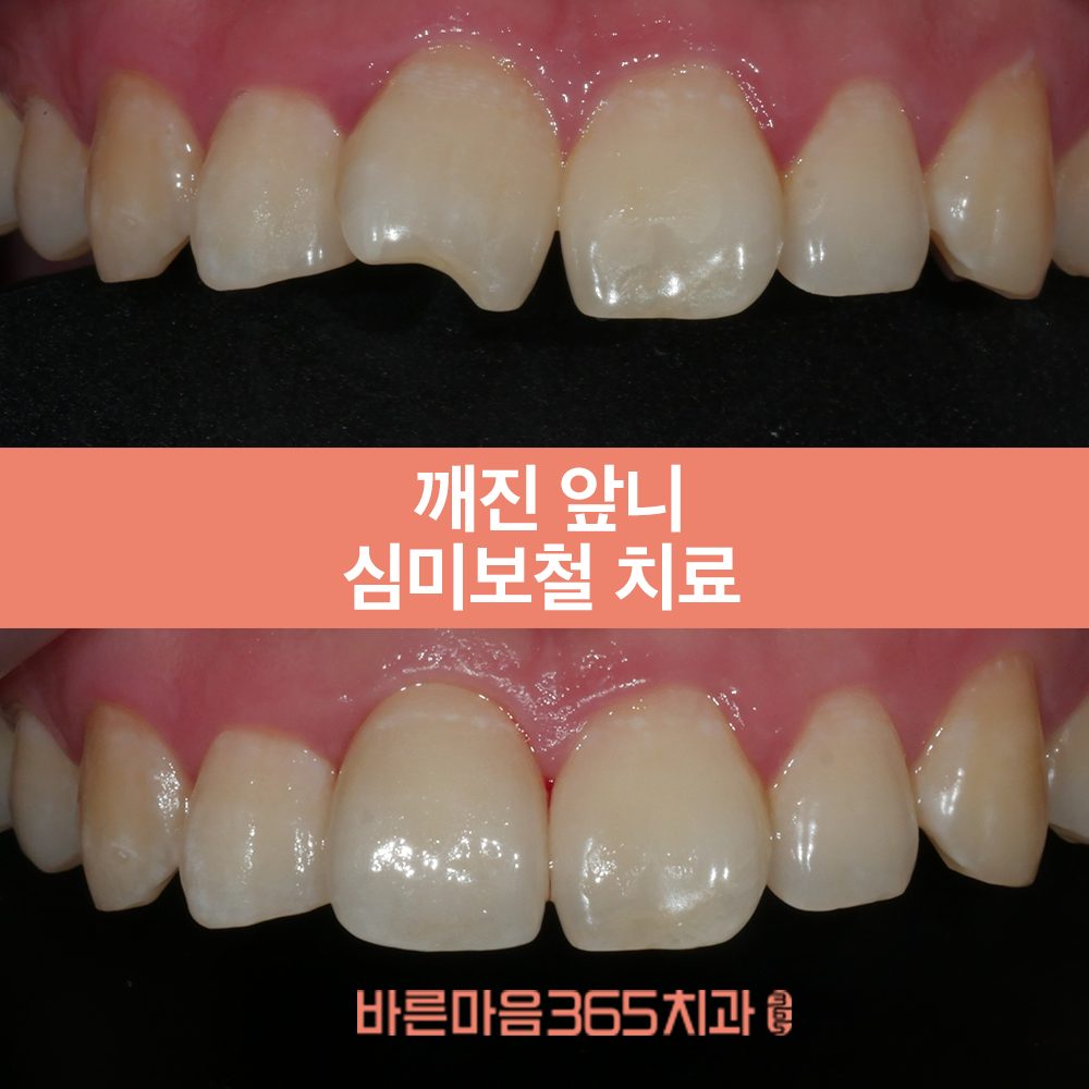 울산삼산동치과