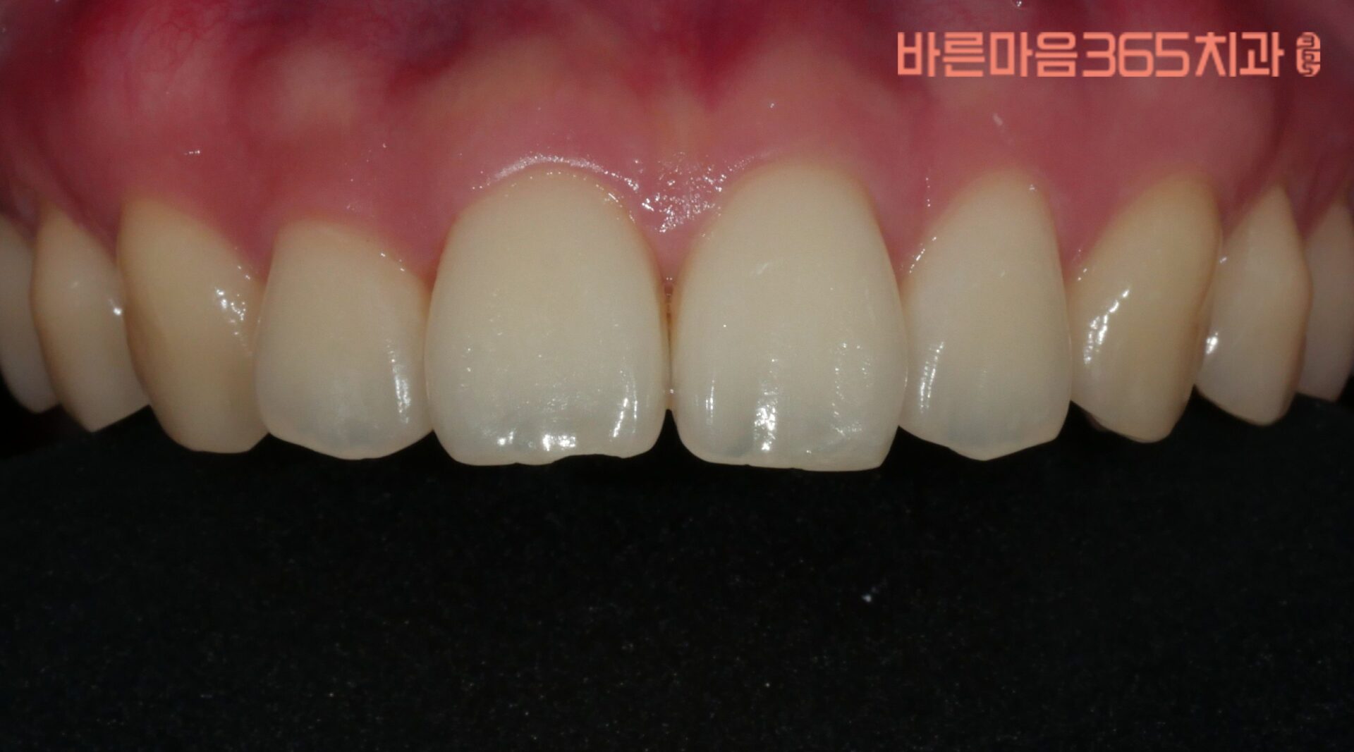 울산삼산동심미보철