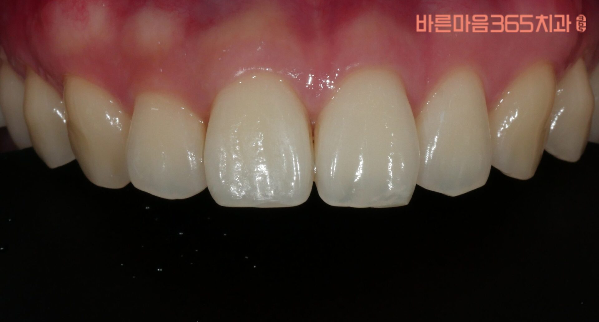 울산삼산동심미보철