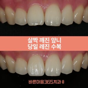바른마음365치과_울산삼산동치과_ 바른마음365치과 블홈썸네일0