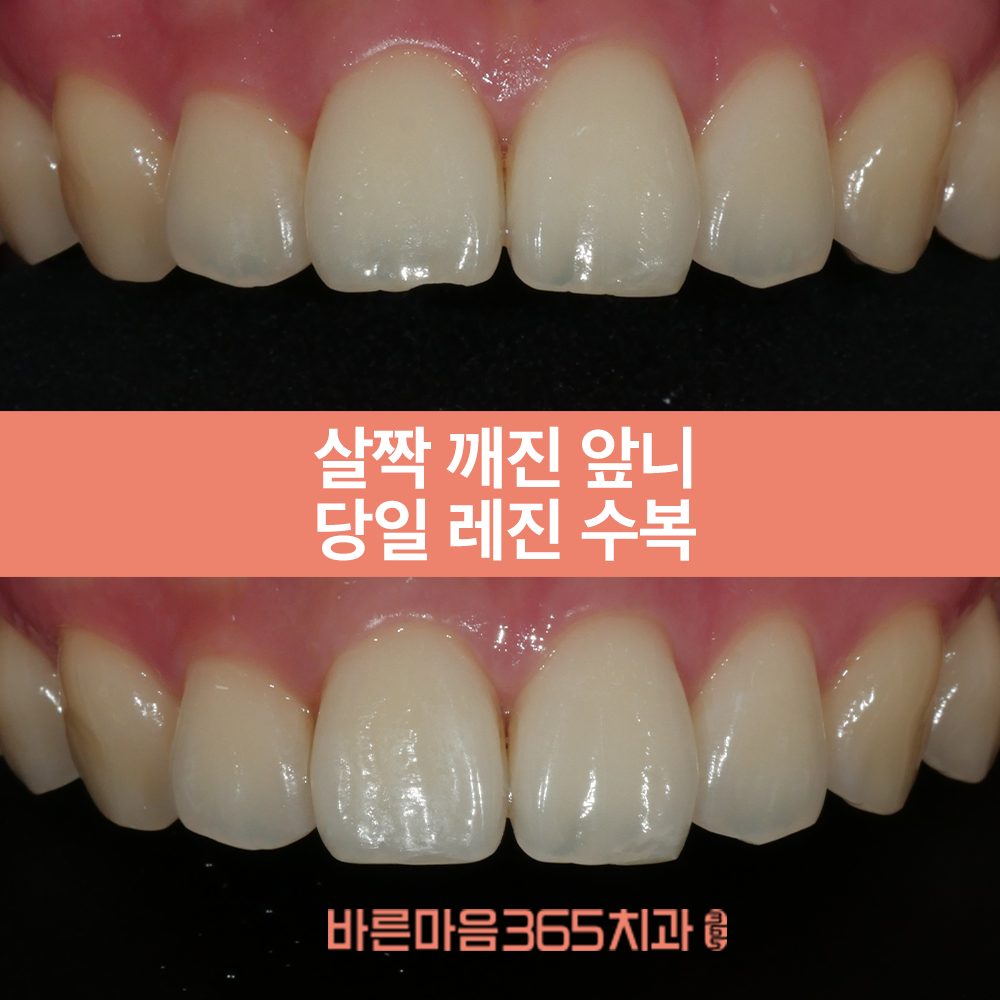 울산삼산동심미보철