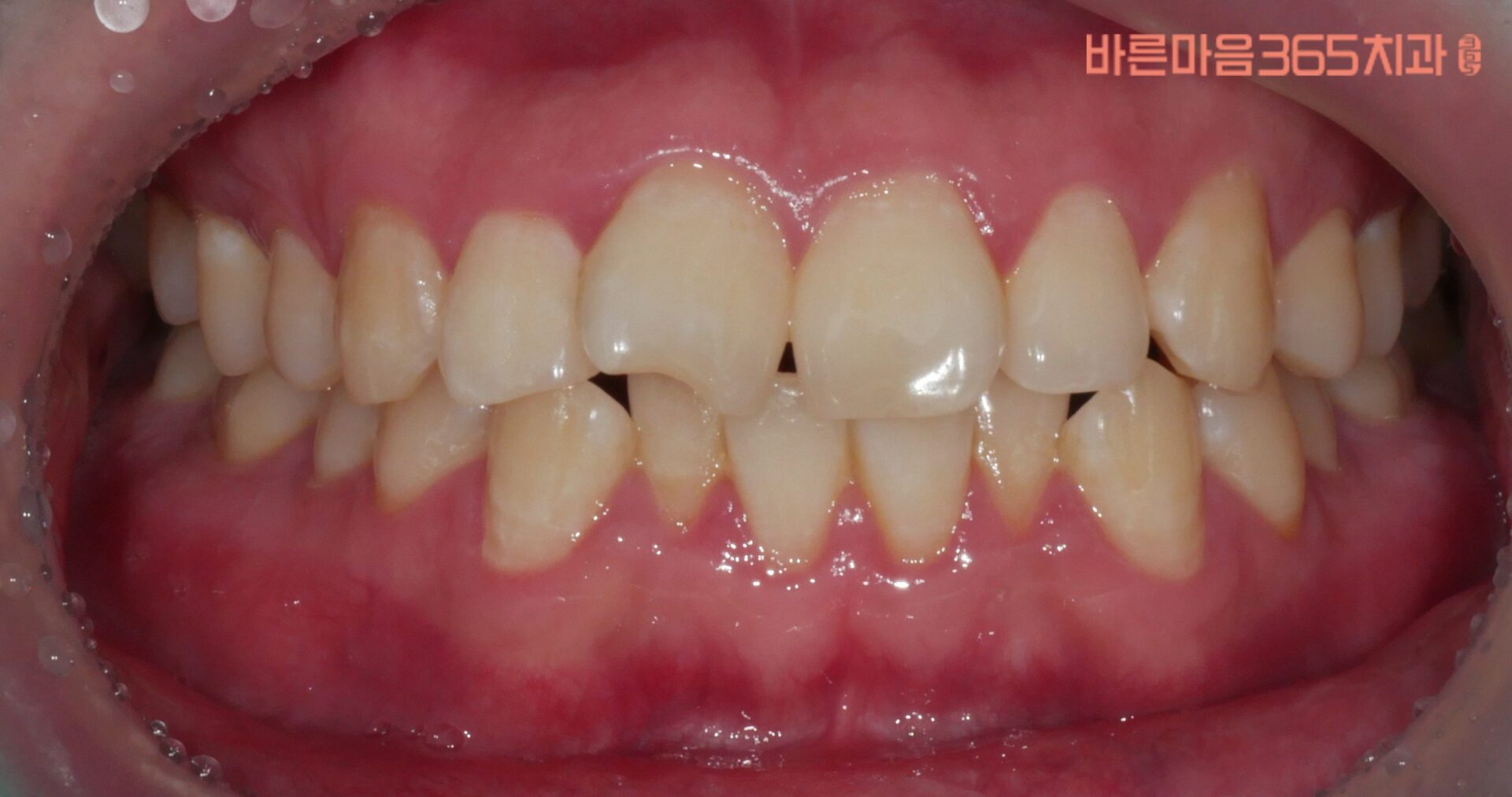 울산삼산동치과