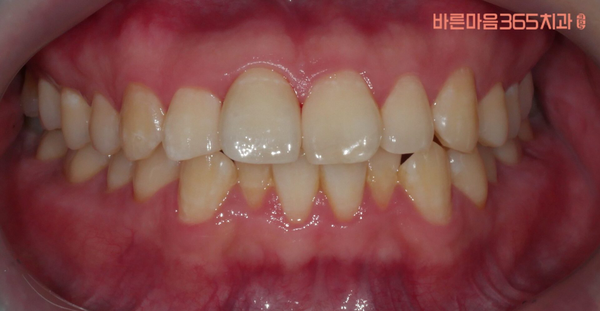 울산삼산동치과